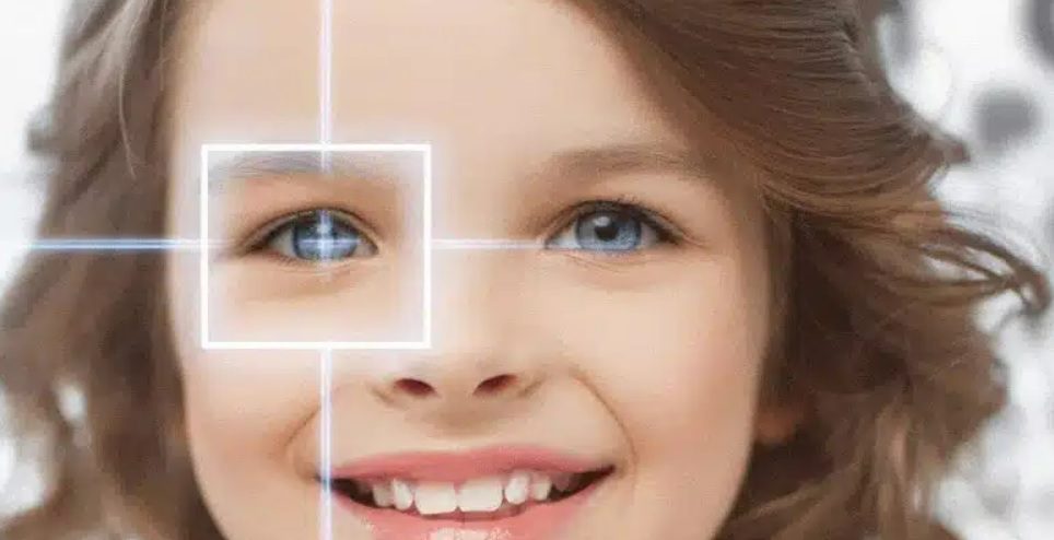 Amblyopia