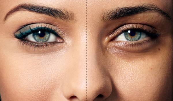 سیاهی زیر چشمچه دلایلی دارد؟